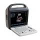 KCD-1000 (Color Doppler)  Standard Configuration---with 1 Convex array probe 