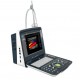 KDW 6100 (Phased array color Doppler)  Standard Configuration---with 1 Convex array probe