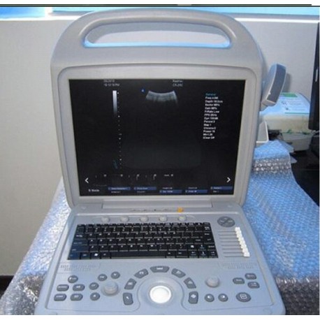 OPENO 480 (3D Color Doppler)  Standard Configuration---with 1 Convex array probe